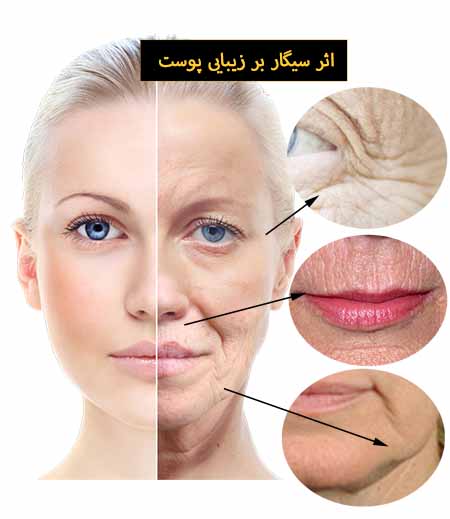 سیگار و زیبایی پوست
