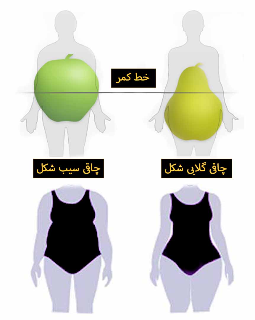 چاقی سیب شکل و گلابی شکل