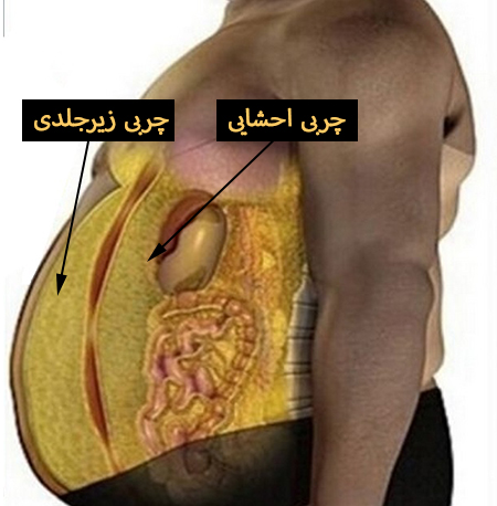 چربی احشایی