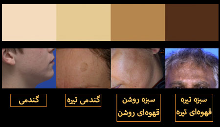تیپ پوستی در ایران