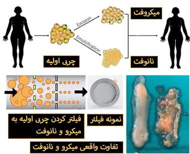 تزریق نانوفت