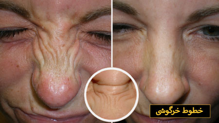 خط خرگوشی