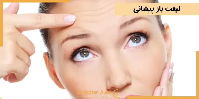 لیفت-باز-پیشانی