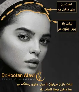 نحوه-برش-برای-حذف-چین-و-چروک