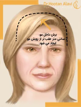 نحوه-برش-برای-طول-و-فرم-پیشانی