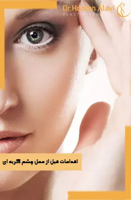 اقدامات-قبل-از-عمل-چشم-گربه-ای