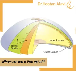 تاثیر-نوع-پروتز-بر-روی-بروز-سرطان