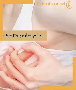 علائم-بیماری-پروتز-سینه