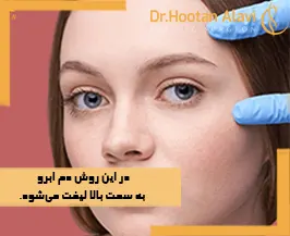 عمل-چشم-گربه-ای-با-لیفت-شقیقه