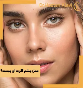 عمل-چشم-گربه-ای-چیست؟