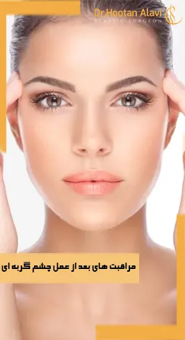 مراقبت-های-بعد-از-عمل-چشم-گربه-ای