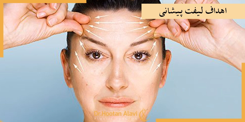 اهداف-لیفت-پیشانی-را-بدانید