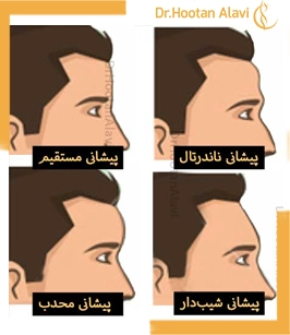 تغییر-شکل-پیشانی