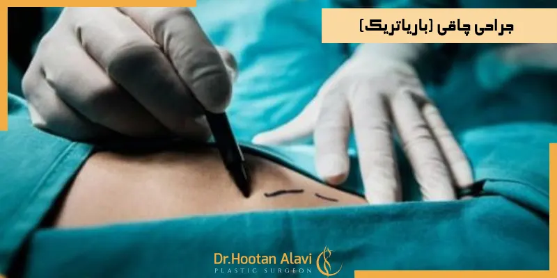 جراحی-چاقی-باریاتریک