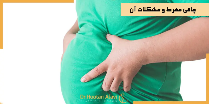 چاقی-مفرط-و-مشکلات-آن