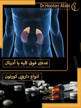 کورتون-چیست؟