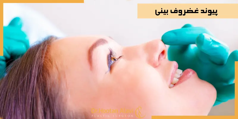 پیوند-غضروف-بینی