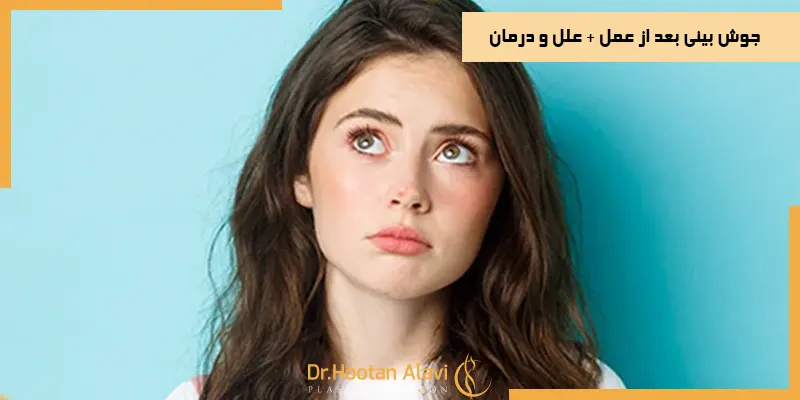جوش-بینی-بعد-از-عمل-علل-و-درمان