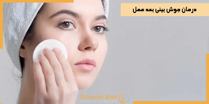 درمان-جوش-بینی-بعد-عمل