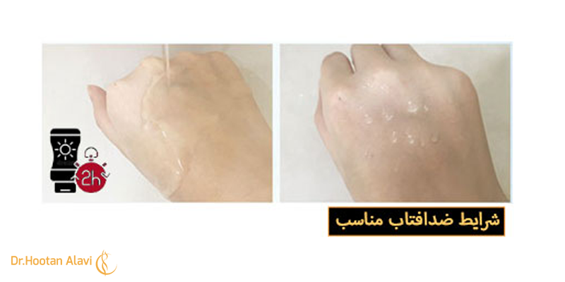 استفاده-از-ضد-آفتاب