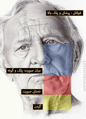 اصلاح-افتادگی-صورت