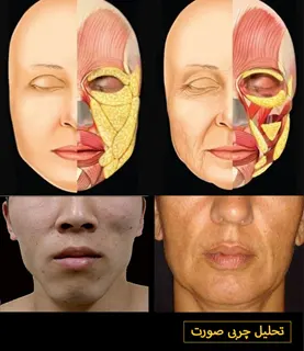 اصلاح-حجم-صورت