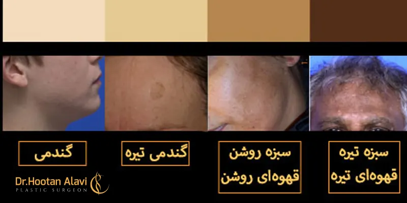 تیپ-پوستی-در-ایران