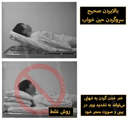 خوابیدن-بعد-از-جراحی-لیفت-صورت