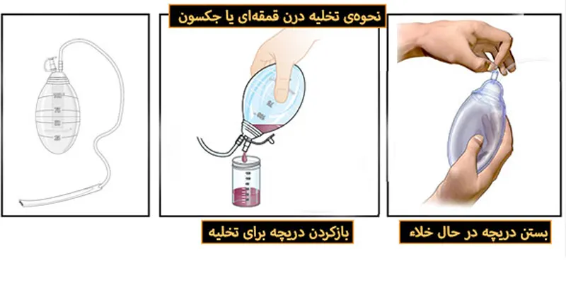نحوه‌ی-تخلیه‌ی-درن-قمقمه‌ای-جکسون
