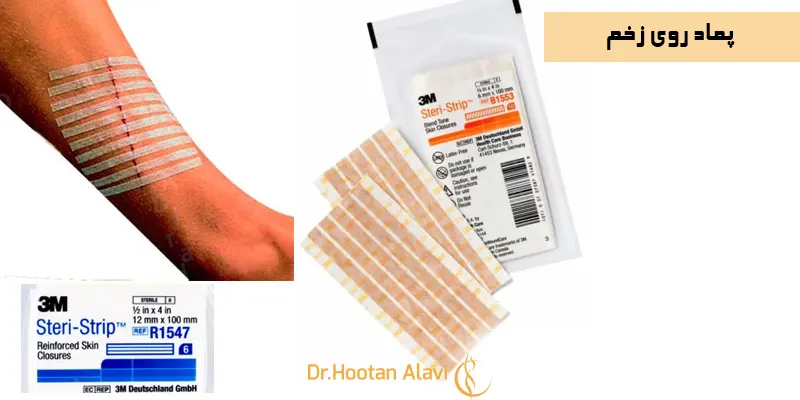 پماد-روی-زخم